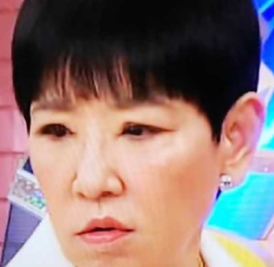 整形 あっこ さん